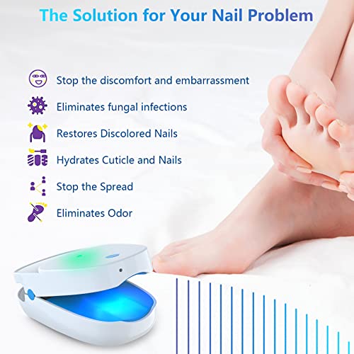 Устройство за почистване на ноктите от гъбички iKeener, улучшающее състояние грозни нокти на ръцете и краката,