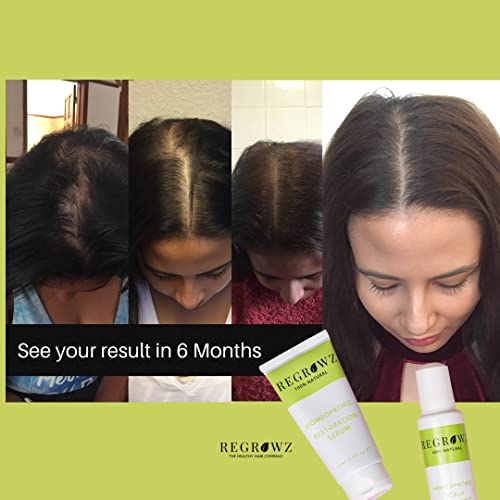 Средство за естествения растеж на косата и тяхното загуба на Regrowz за жени - Обогащено ДХТ блокери и органични