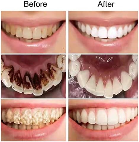 Никотинамид Избелваща Зъбите Паста за зъби Премахва Петна плака Жълти Зъби Хигиена на устната Кухина, Почистване на Свеж