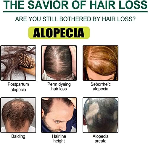 TGMALL Копър, За да се придаде Плътност на Косата,Копър За растежа на косата, Подхранване на Джинджифил Спрей, Спрей за Растежа на косата за жени,Серум За Лечение на кос