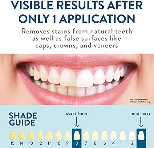 Набор от устройства за избелване на зъбите LOVE YOUR - Система за избелване на зъби с мундштуком с led подсветка в синьо - Белина за зъби в домашни условия - Клинично теств?