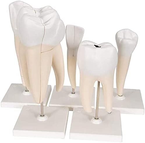 Wzqwzj Модел на човешки орган Модел на Зъба, 5 Модели на Интелектуална Модел Анатомия на Зъбите Подвижна Режим на